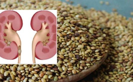 Uttarakhand: शोध से सामने आया पथरी का इलाज, जानिए किस दाल में है इसका समाधान