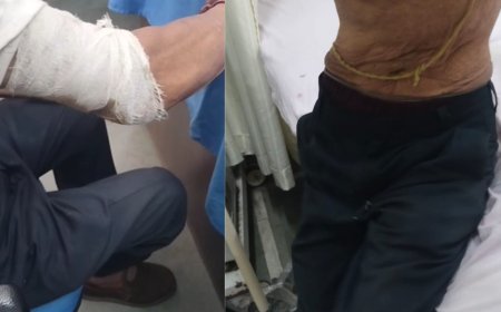 Rudraprayag: गुलदार ने शख्स पर किया हमला, श्रीनगर बेस अस्पताल भर्ती