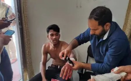 डीएवी पीजी कॉलेज में सांस्कृतिक कार्यक्रम के दौरान हिंसा, छात्र पर चाकू से हमला