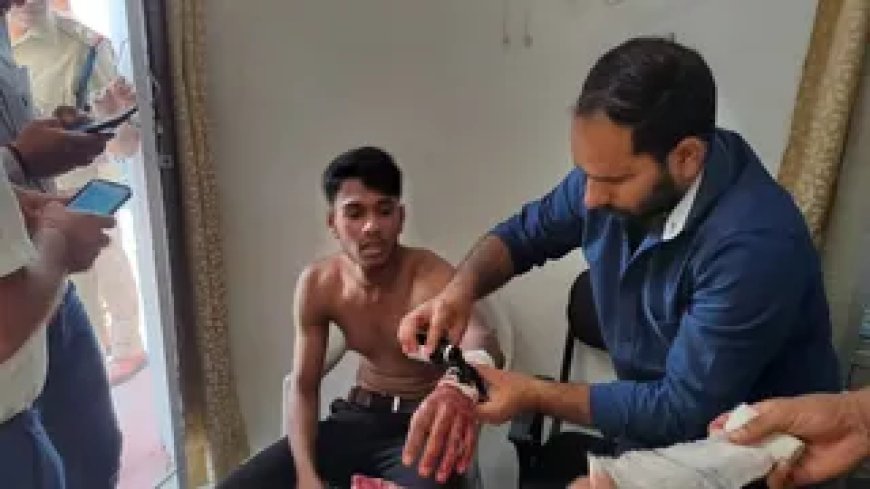 डीएवी पीजी कॉलेज में सांस्कृतिक कार्यक्रम के दौरान चाकू से हमला, छात्रों में मची अफरातफरी